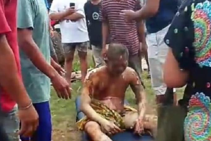 Ledakan Sumur Ilegal di Bayung Lincir, 4 Pekerja Gosong Terbakar Api